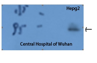 STAT3 Antibody