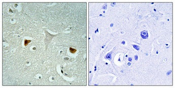 STAT3 Antibody