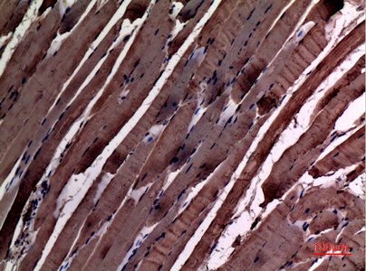 ACTC1 Antibody