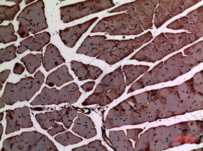 ACTC1 Antibody