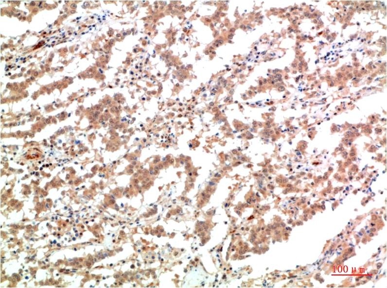 JAK2 Mouse Monoclonal Antibody