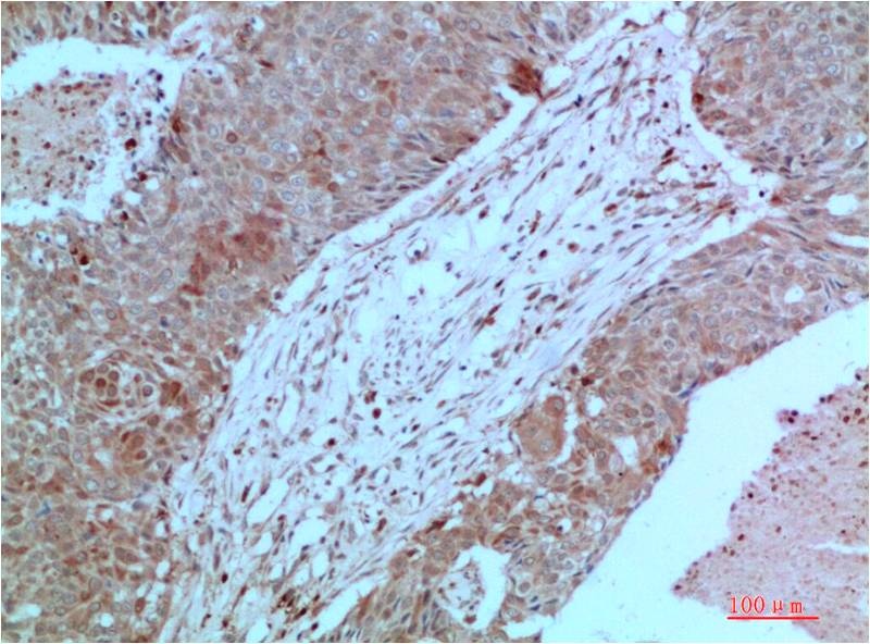 JAK2 Mouse Monoclonal Antibody