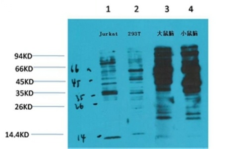 Phospho-Tyrosine (6G6) Mouse mAb