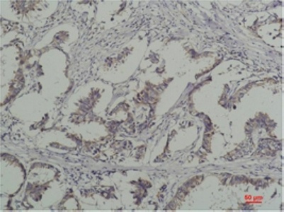 Phospho-Tyrosine (6G6) Mouse mAb Antibody