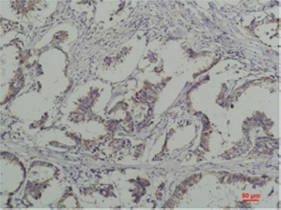 Phospho-Tyrosine (6G6) Mouse mAb