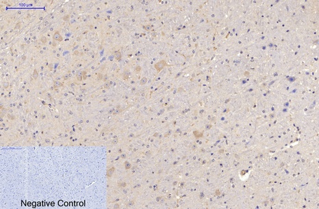 MAP2 (3B5) Mouse mAb