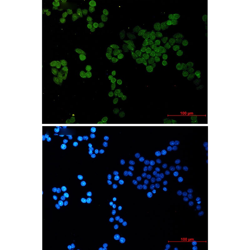 CRCP Antibody