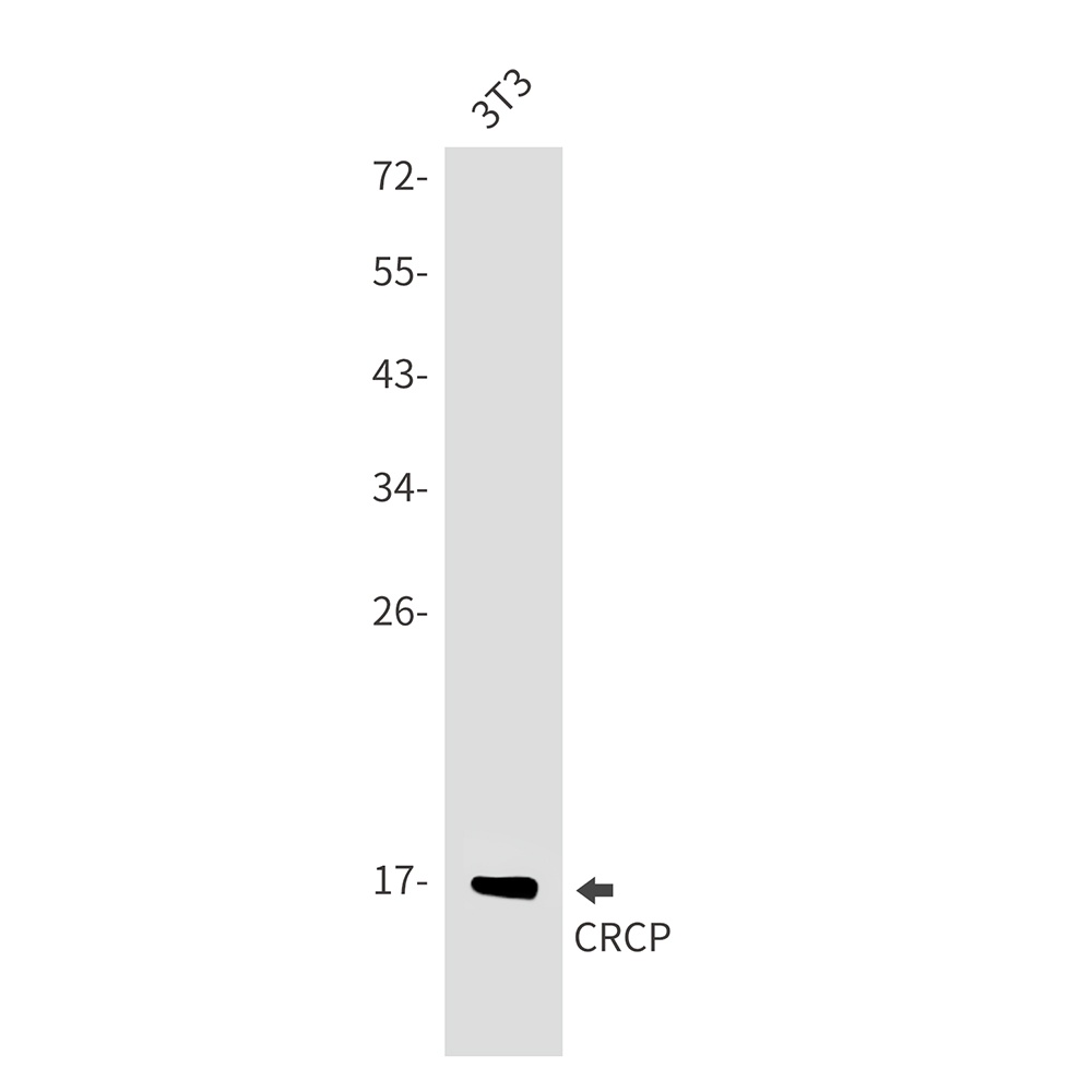 CRCP Rabbit mAb