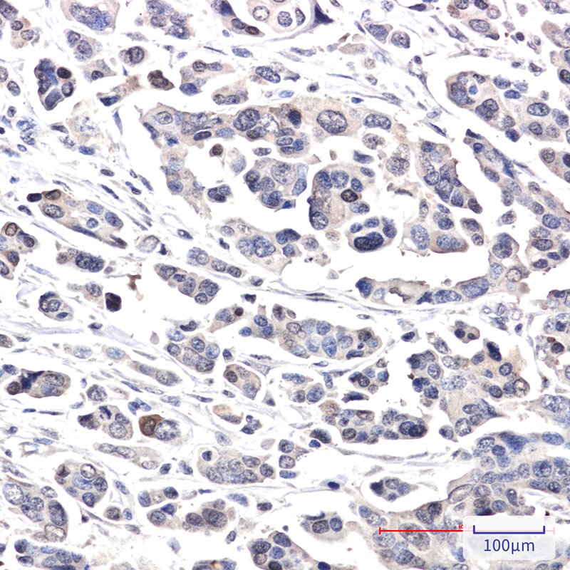 CRCP Rabbit mAb