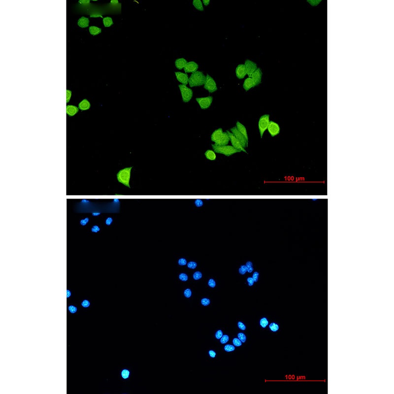 PLK1 Antibody