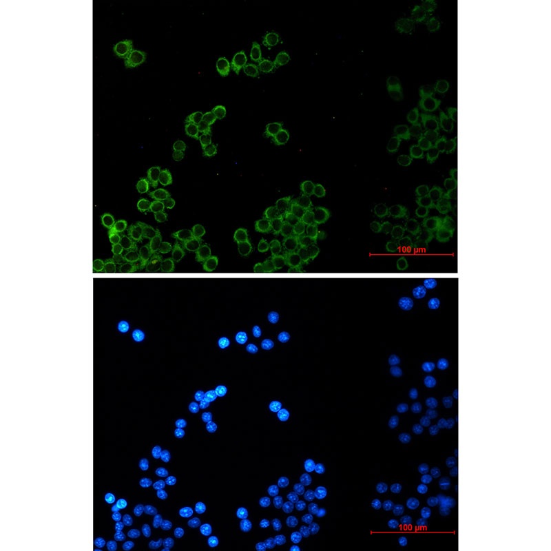 PLAA Antibody