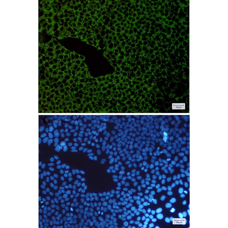 [KD] G3BP Rabbit mAb