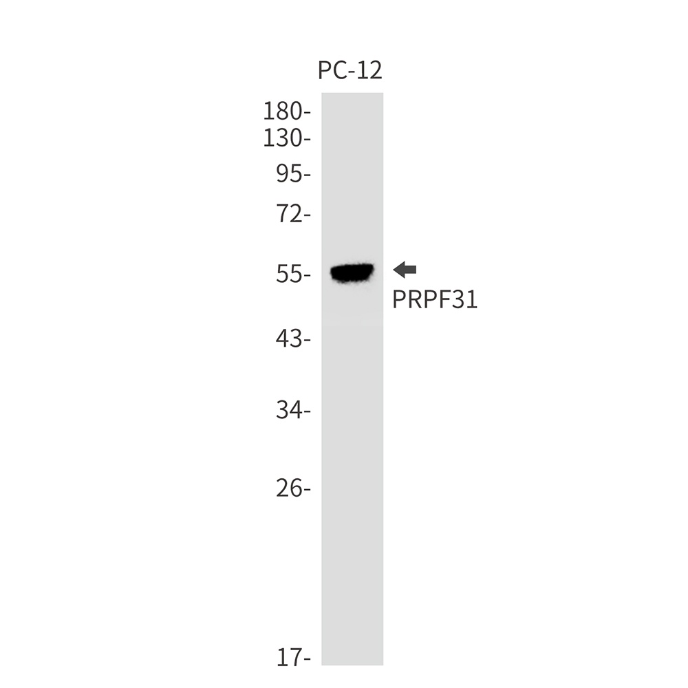 PRPF31 Antibody