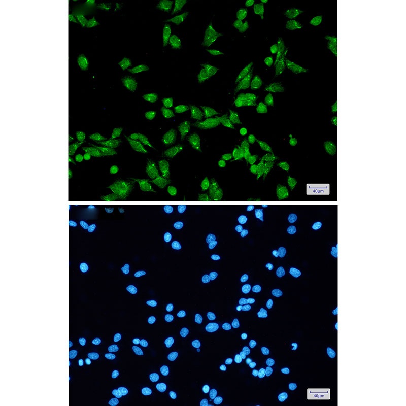PRPF31 Antibody