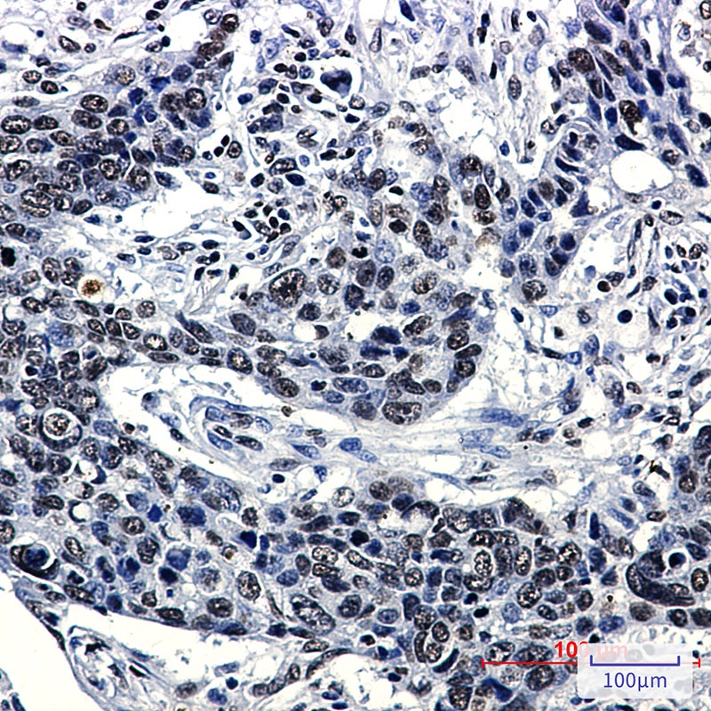 Hydroxyl-Histone H2A (Tyr39) Rabbit Monoclonal Antibody