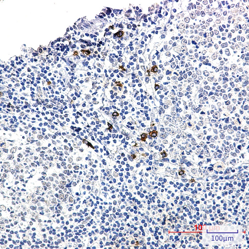 Human IgG4 Rabbit Monoclonal Antibody