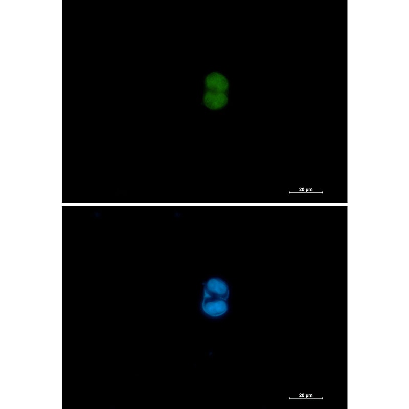 MEK3/MEK6 Rabbit mAb