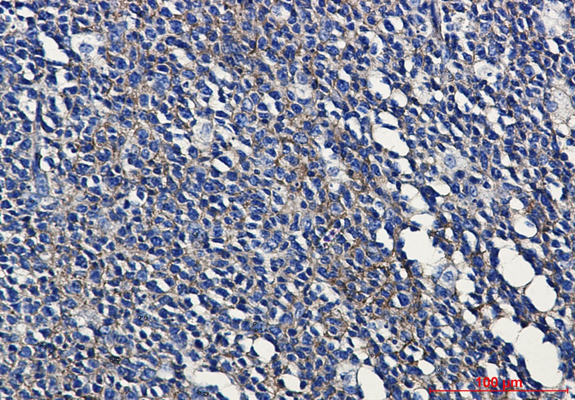 MHC Class I Rabbit mAb