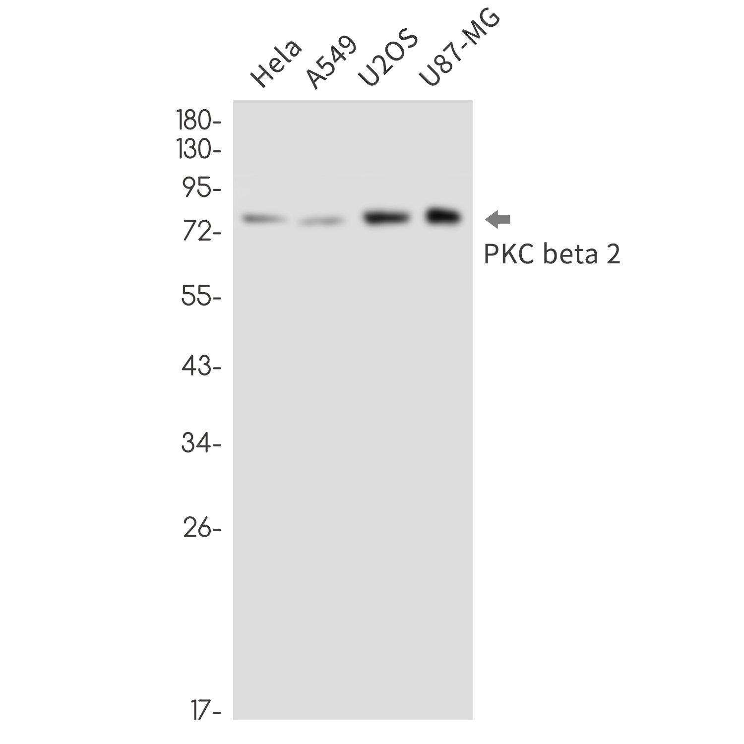 PRKCB Antibody