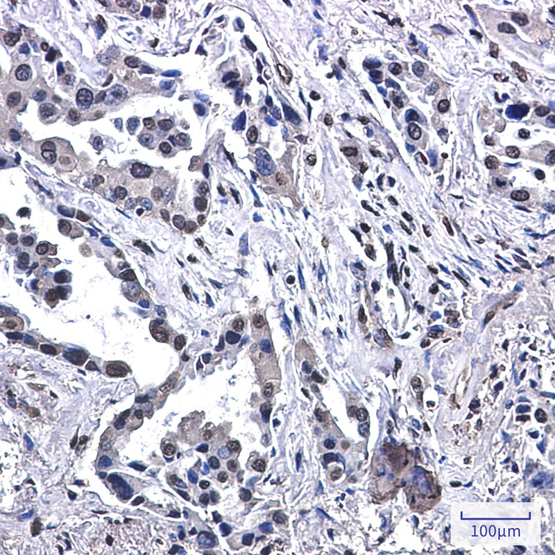 VPS35 Antibody