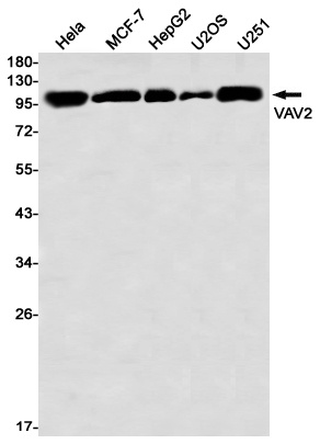VAV2 Rabbit mAb