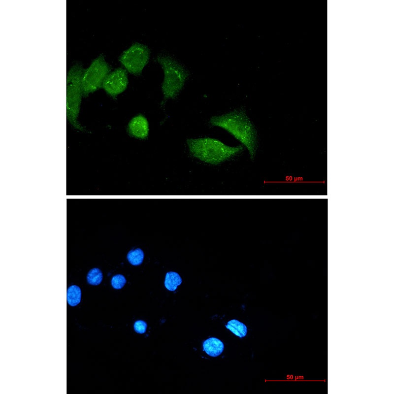 Ubiquitin Conjugation Factor E4 B Rabbit mAb
