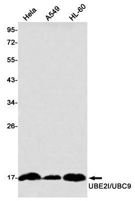 UBE2I Antibody