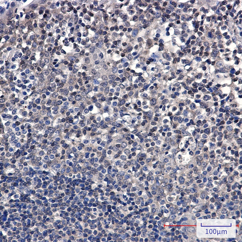 SUMO Conjugating Enzyme UBC9 Rabbit mAb