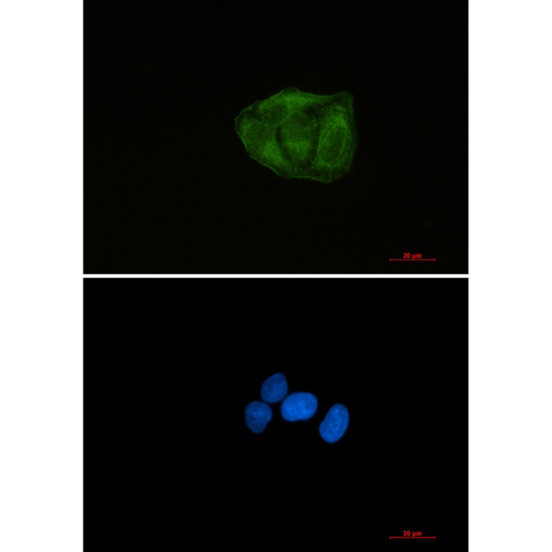 Ubiquitin 60S Ribosomal Protein L40 Rabbit mAb