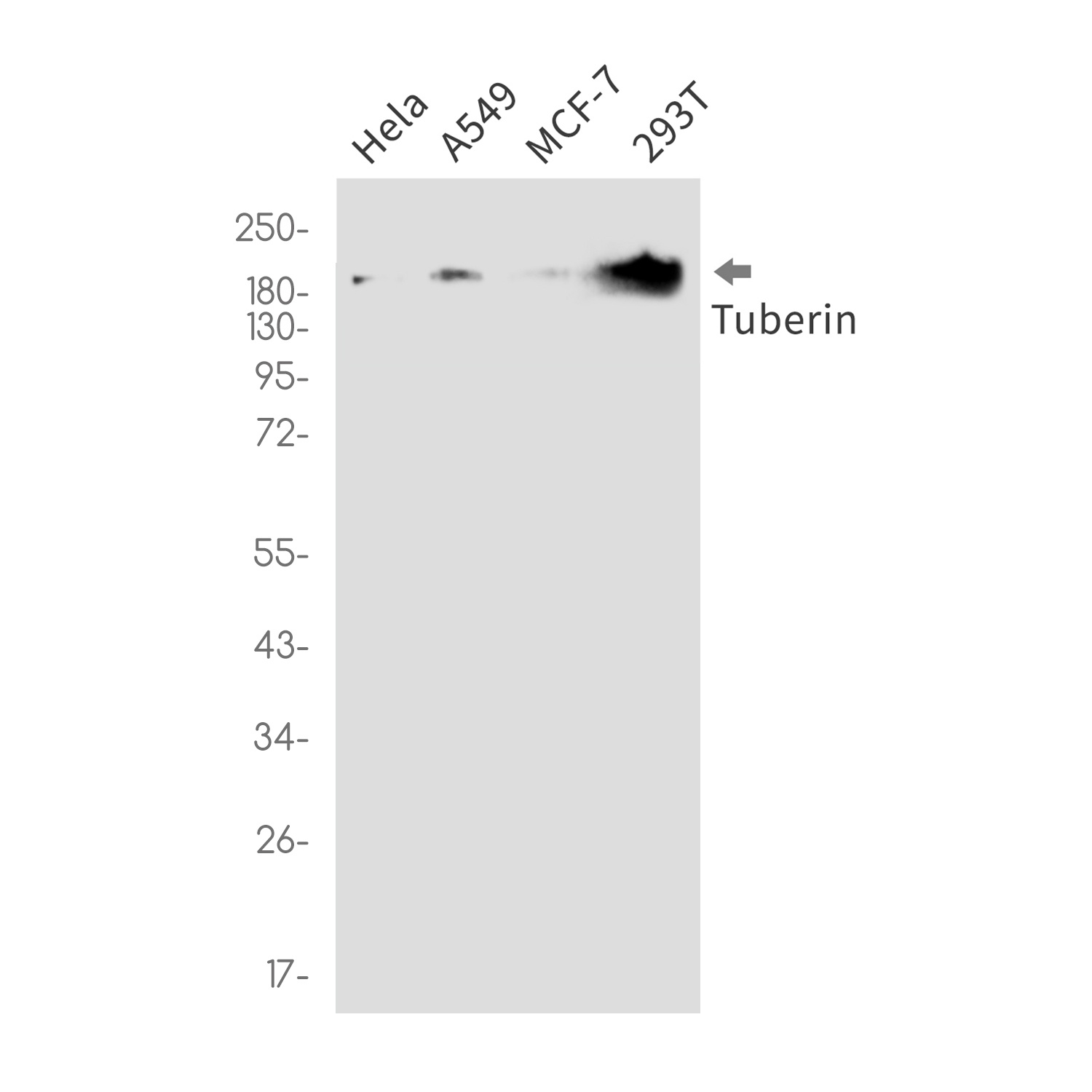 TSC2 Antibody