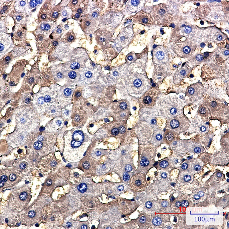 TSC2 Antibody