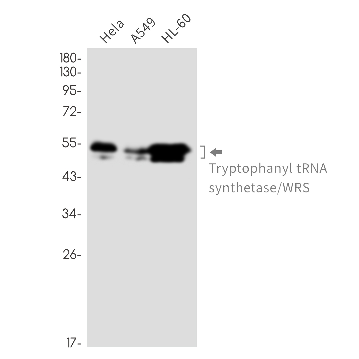 Tryptophan tRNA Ligase Rabbit mAb