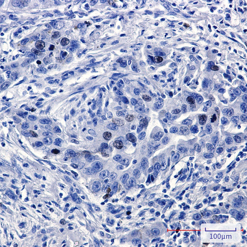 TPX2 Antibody