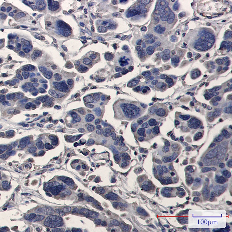 TPMT Rabbit mAb