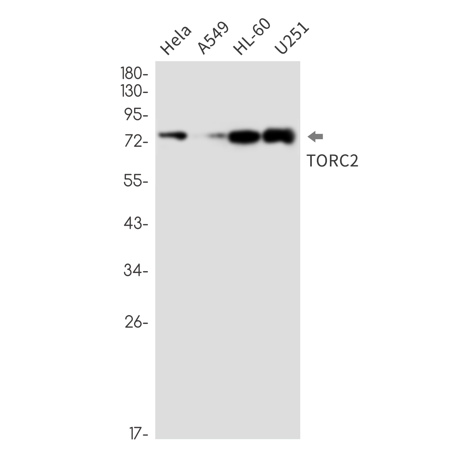 CREB Regulated Transcription Coactivator 2 Rabbit mAb