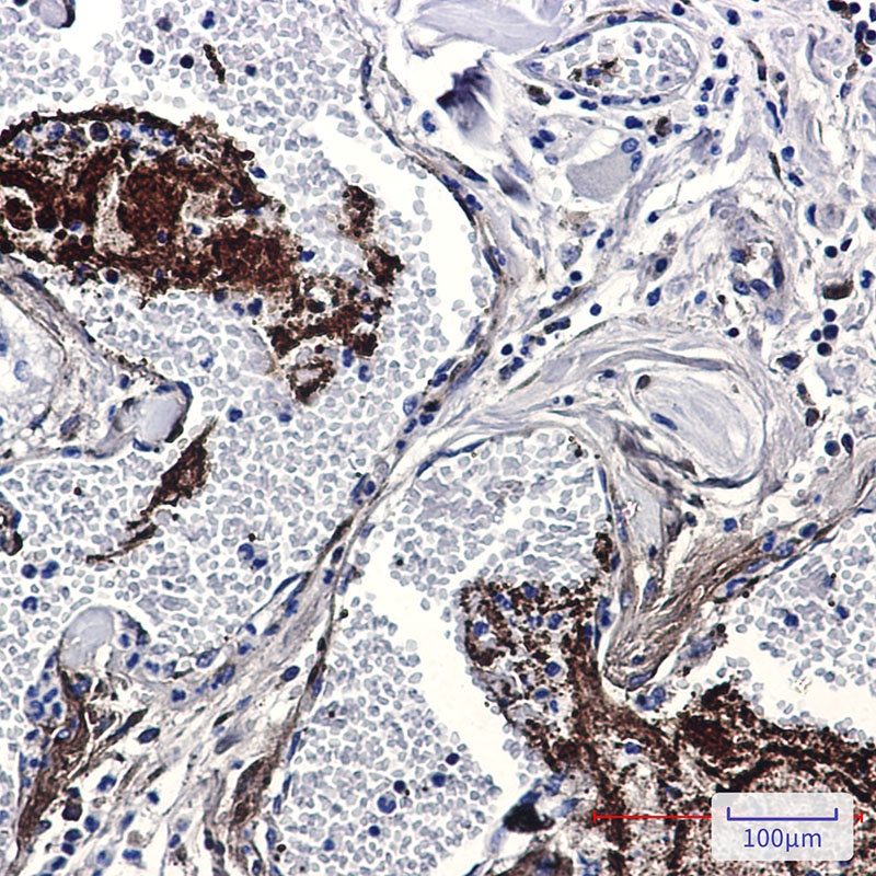 THBS1 Antibody