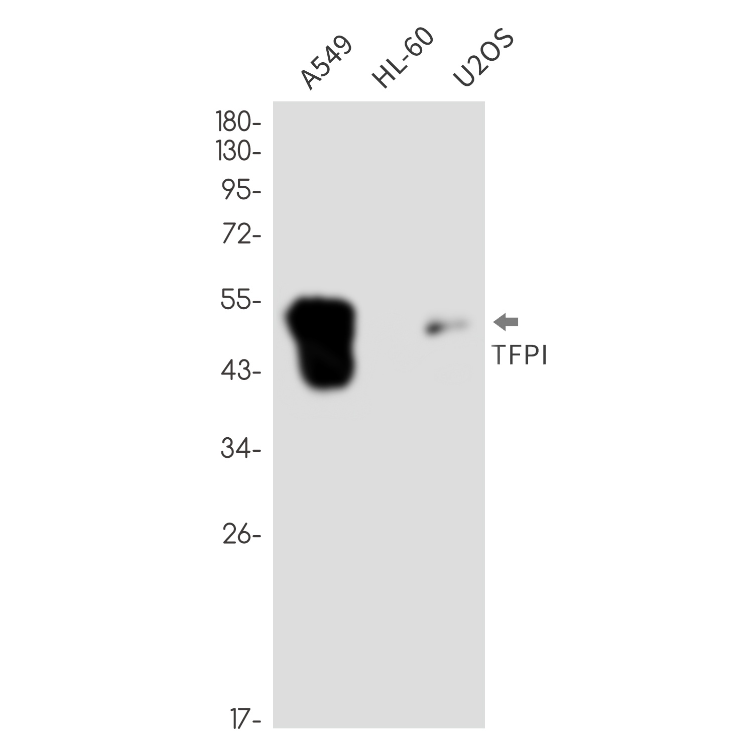 Tissue Factor Pathway Inhibitor Rabbit mAb