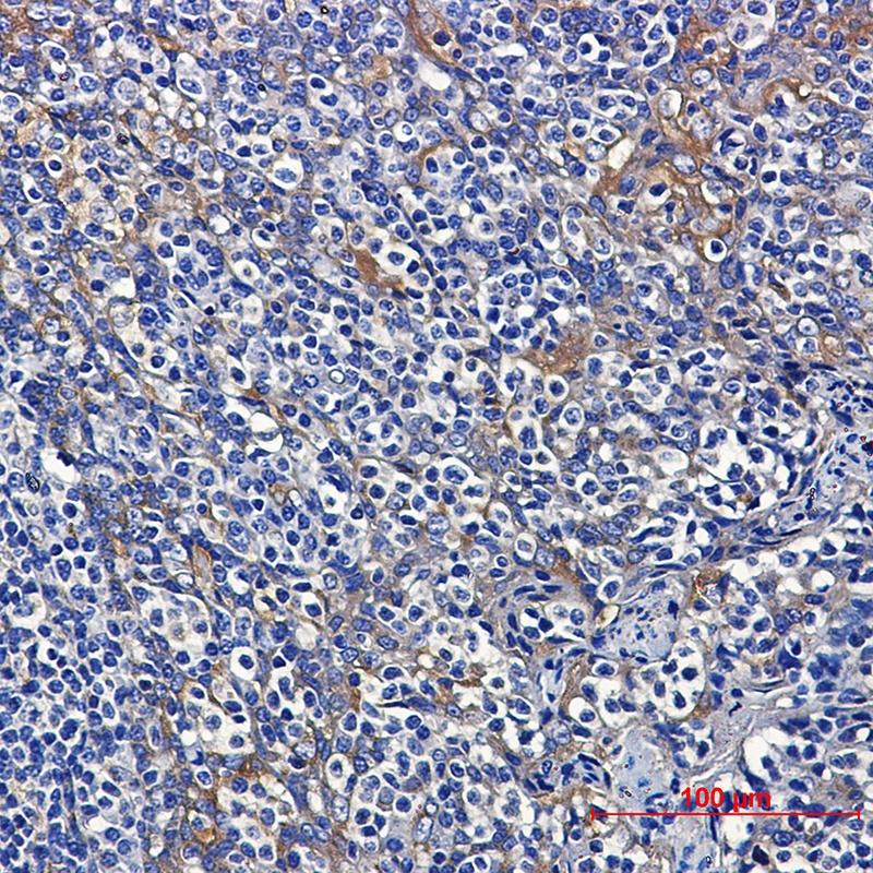 Dynein Light Chain Tctex Type 1 Rabbit mAb