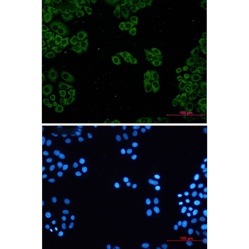 TCP 1 alpha Rabbit mAb