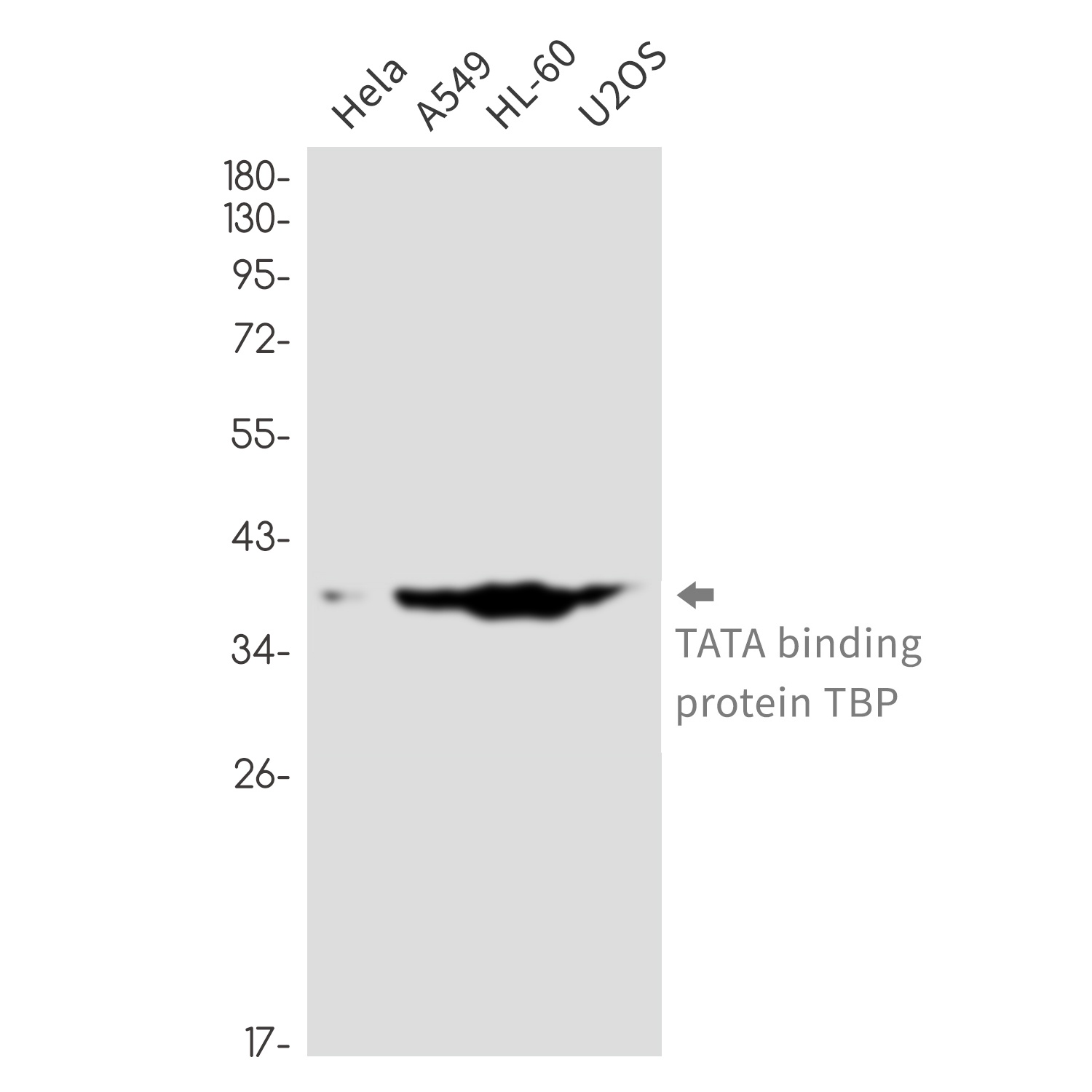 TBP Antibody