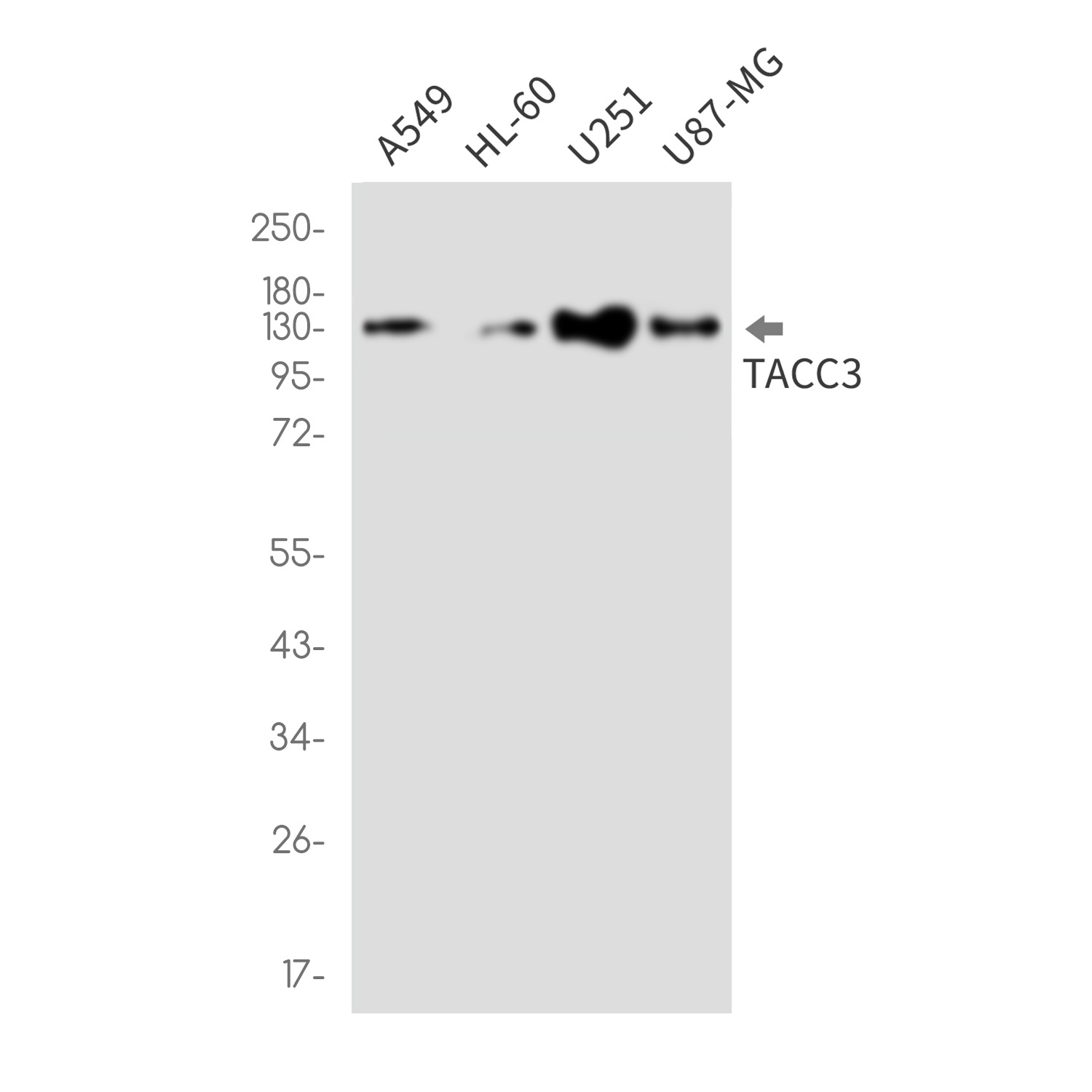 TACC3 Antibody