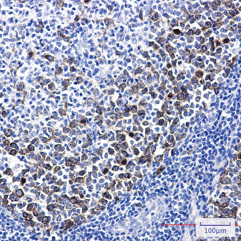 TACC3 Antibody