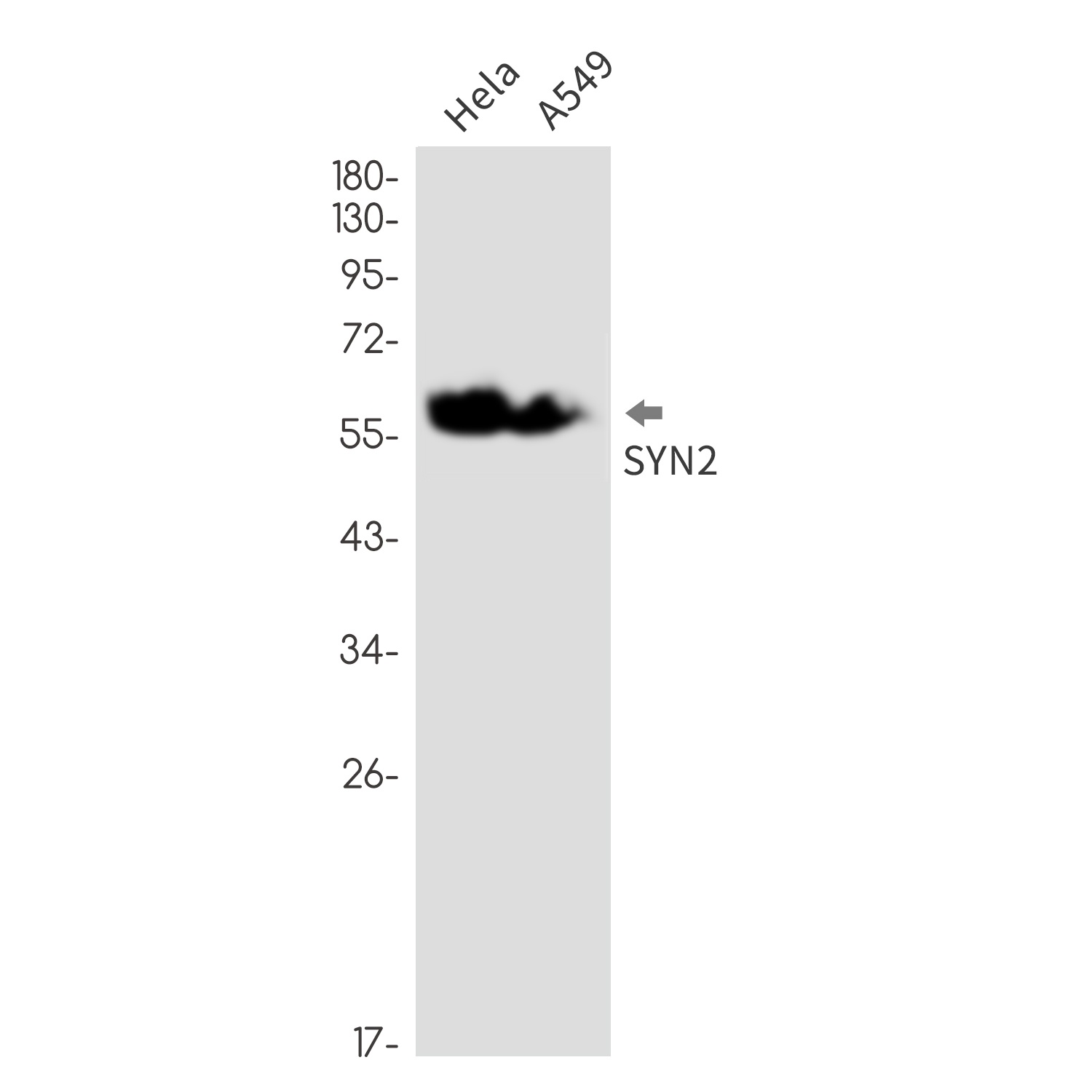 Synapsin 2 Rabbit mAb