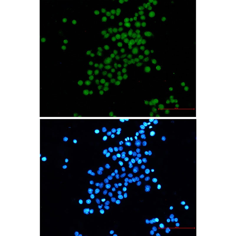 SV40 T Antigen Rabbit mAb