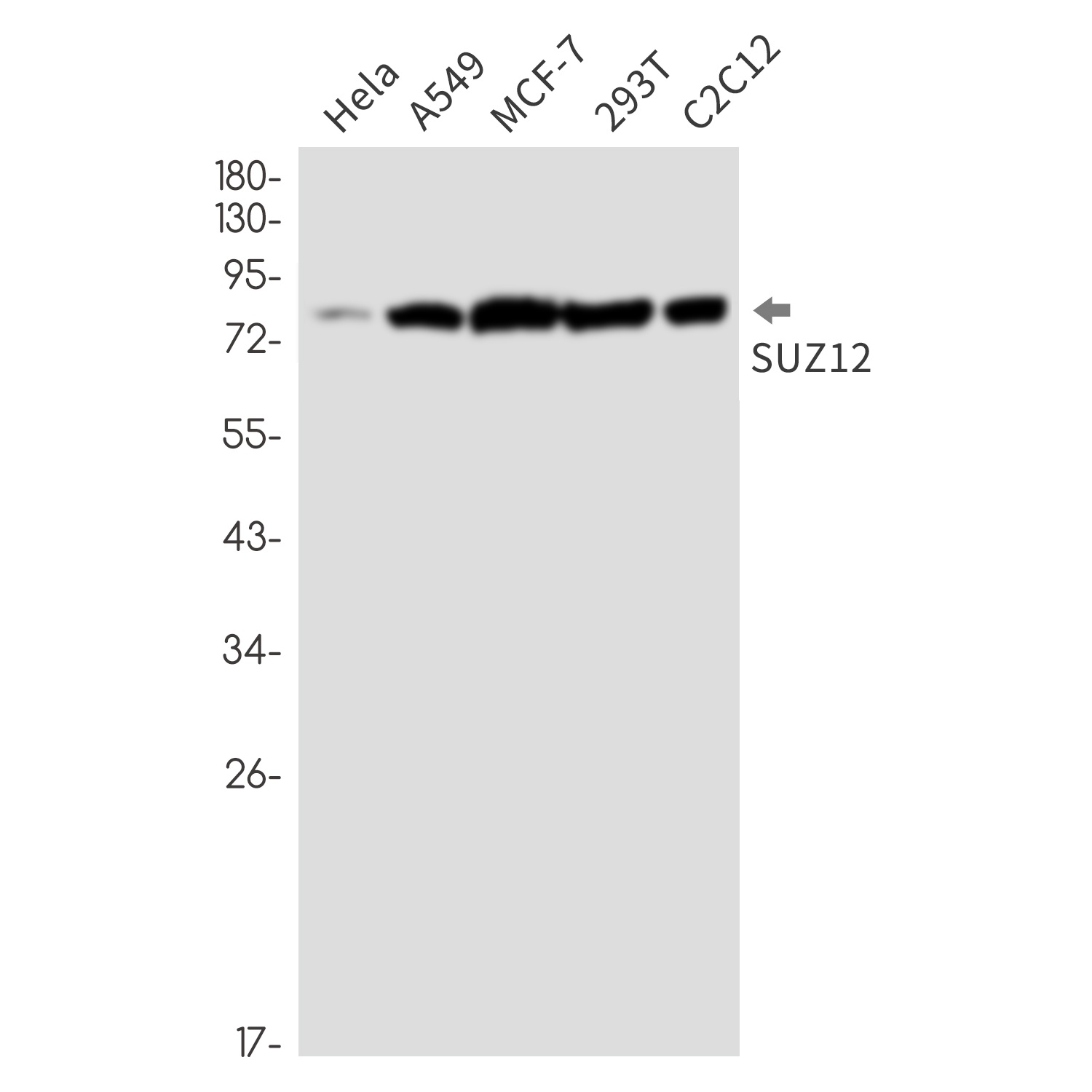 SUZ12 Rabbit Monoclonal Antibody