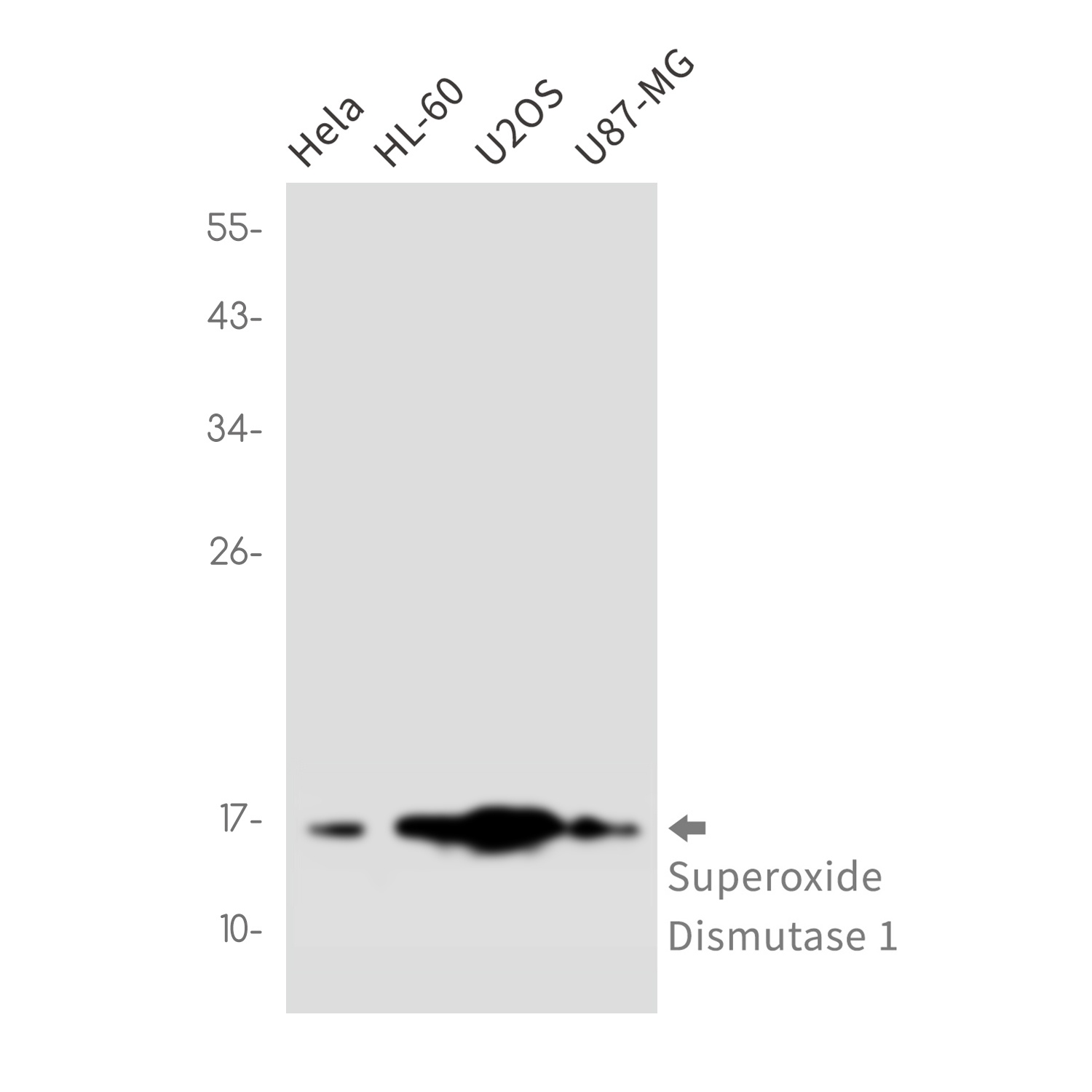 Superoxide Dismutase 1 Rabbit mAb