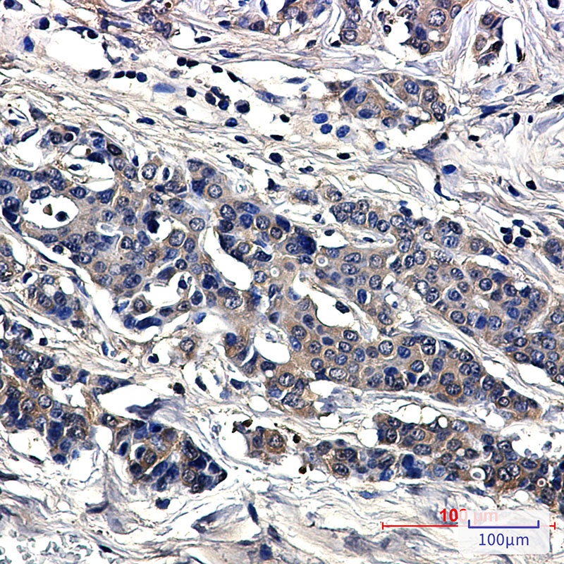 Superoxide Dismutase 1 Rabbit mAb