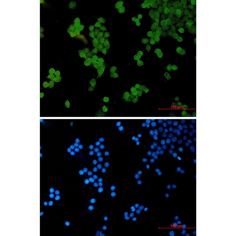 STAT5B Antibody