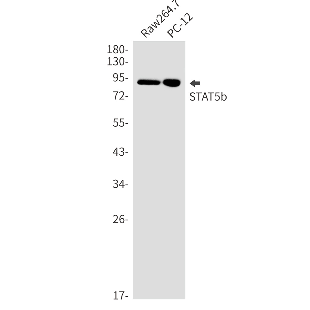 STAT5b Rabbit mAb