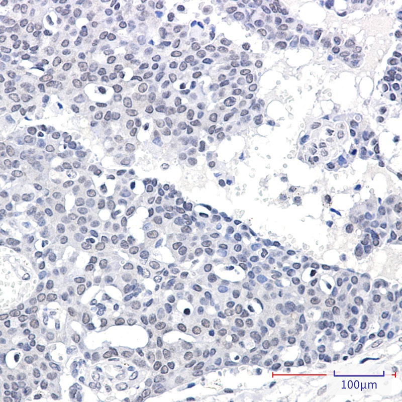 SPT5 Rabbit mAb
